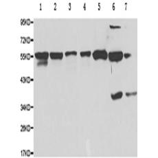 兔抗P4HB多克隆抗體