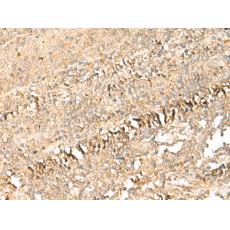 兔抗PSD4多克隆抗體