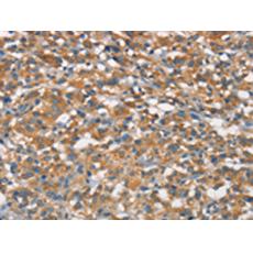 兔抗NAXE多克隆抗體