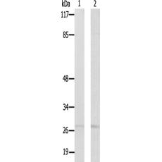 兔抗NPDC1多克隆抗體