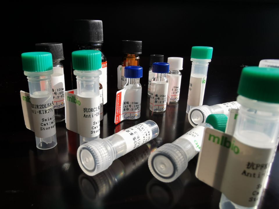 UTS2抗原（重組蛋白）